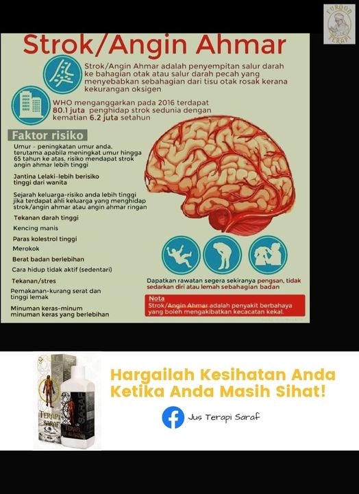 Strok Adalah Serangan Otak Dan Terjadi Apabila Bekalan 