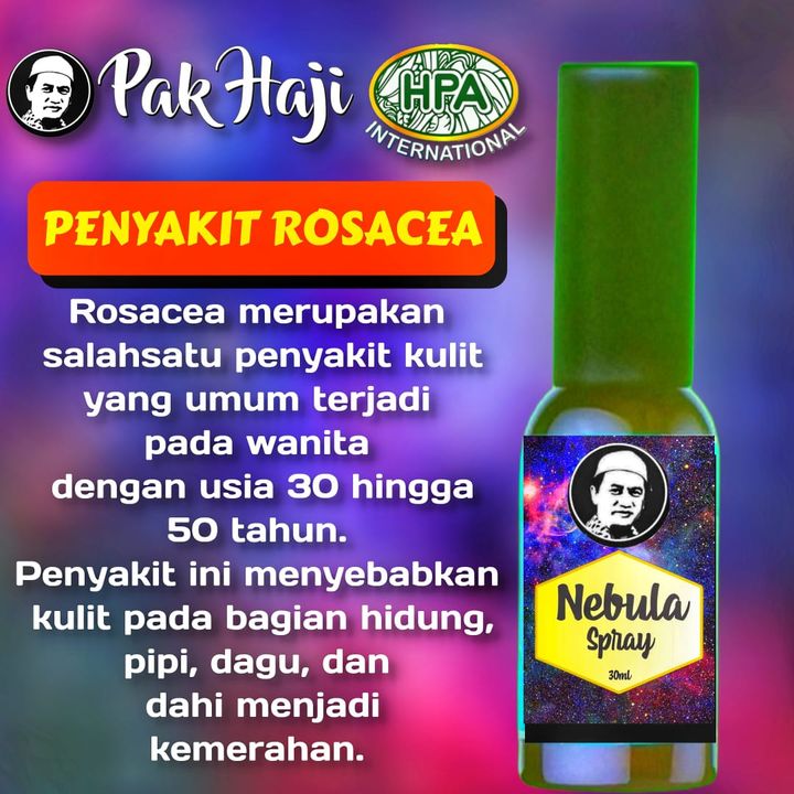 Penyakit Rosacea 