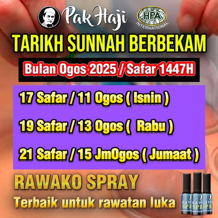 *tarikh Sunnah Berbekam* 