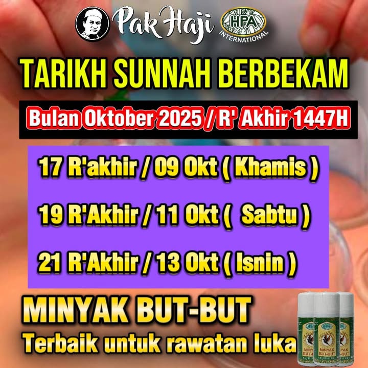 *tarikh Sunnah Berbekam* 
