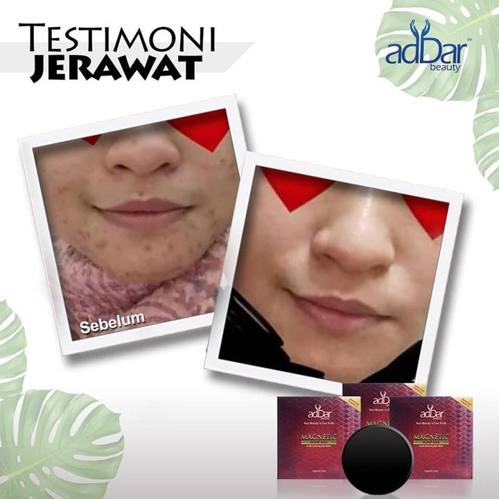 Wow Sangat Perkongsian Testimoni Addar Ni.. 