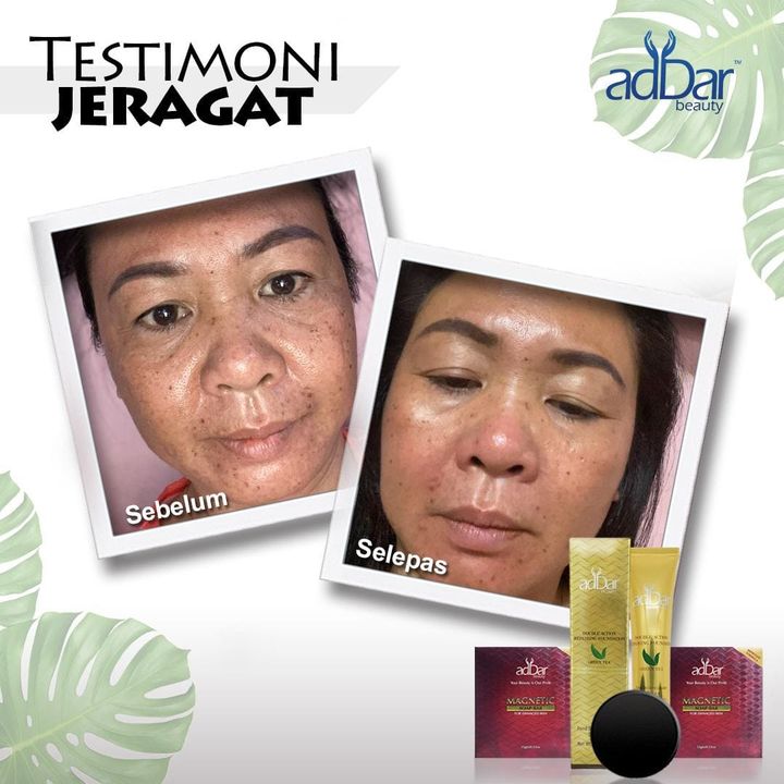 Benda Paling Stress Tengok,jeragat Terlalu Teruk Sampai Rasa 