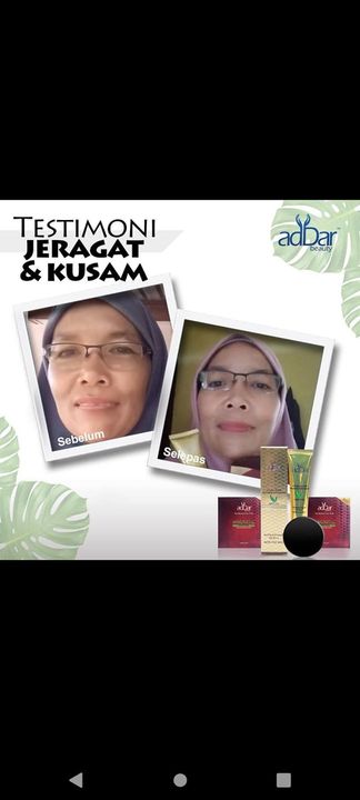 Masalah Jeragat & Kusam Mmg Dah Ada..tapi Dengan 