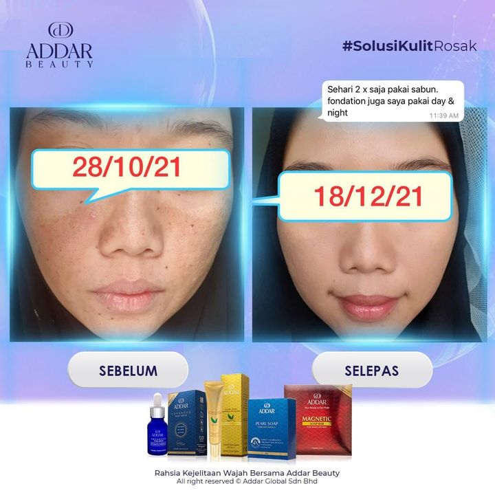 Kalau Boleh Semua Benda Nak Cepat Betul Tak 