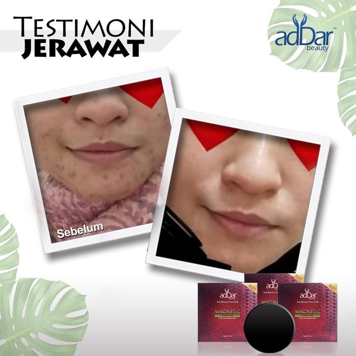 Wow Sangat Perkongsian Testimoni Addar Ni.. 