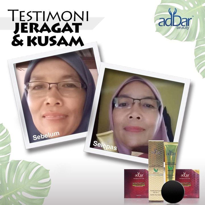 Masalah Jeragat & Kusam Mmg Dah Ada..tapi Dengan 