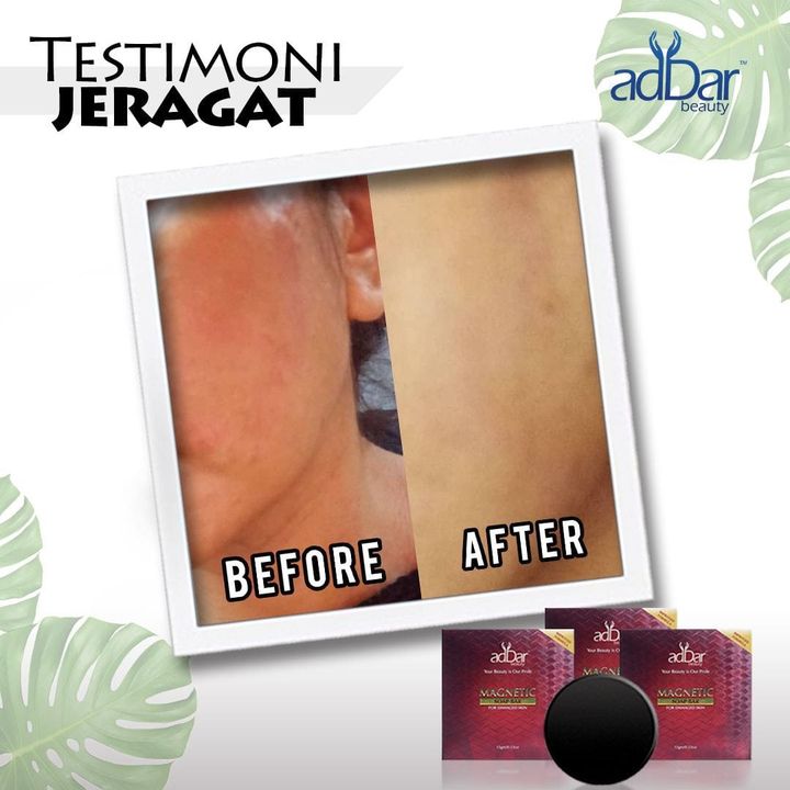 Testimoni Jeragat Dengan Zoom Dekat Di Berikan Oleh 