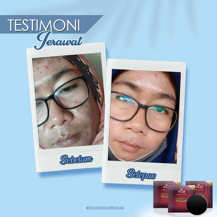 Sabun Magnetic By Addar Sabun Detox No 1 
