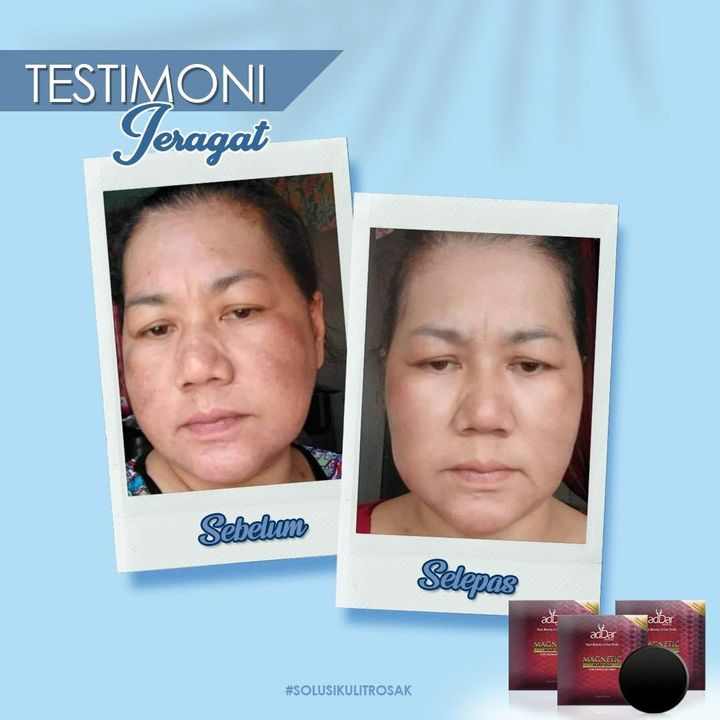 Cantik Itu Unik..jeragat Pun Satu Masalah Yg Unik 
