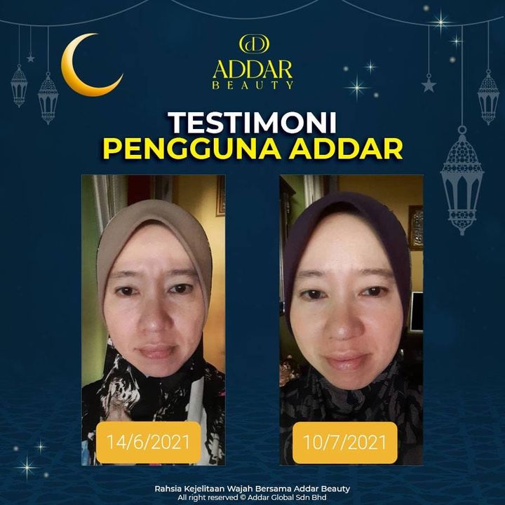 Kulit Kalau Cerah Memang Jelas Nampak Jeragat….betul Tak 