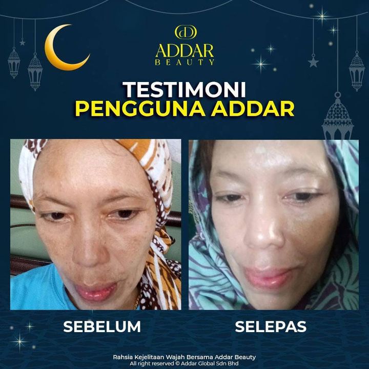 Bukan Main Teruk Jeragat Kalau Berkulit Cerah Kan 