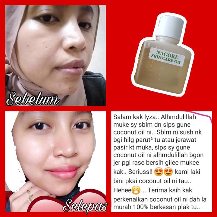 Skincare Oil Ni Banyak Manfaatnya . Bukan Setakat 