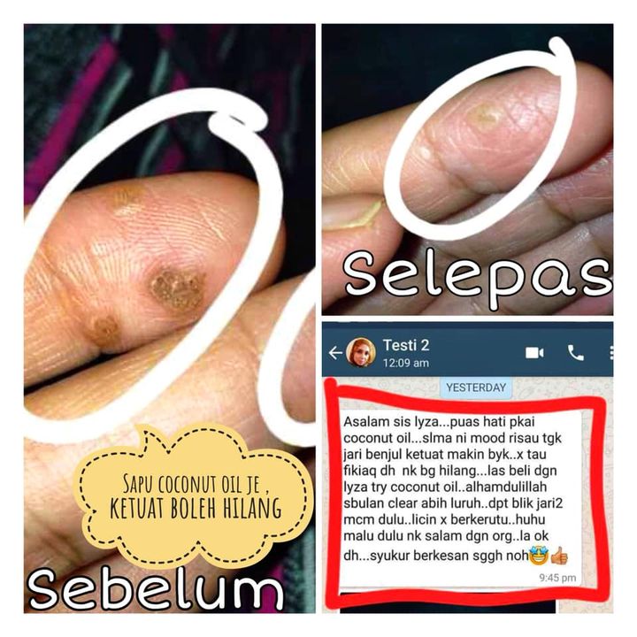 Ketuat Yang Degil Pon Boleh Kalah Dengan Nagoke 