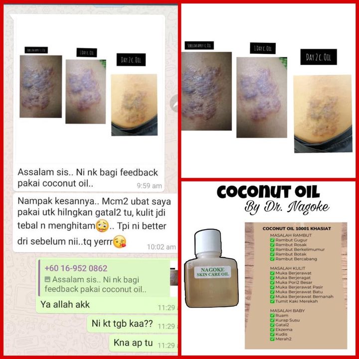Nagoke Skin Care Oil  