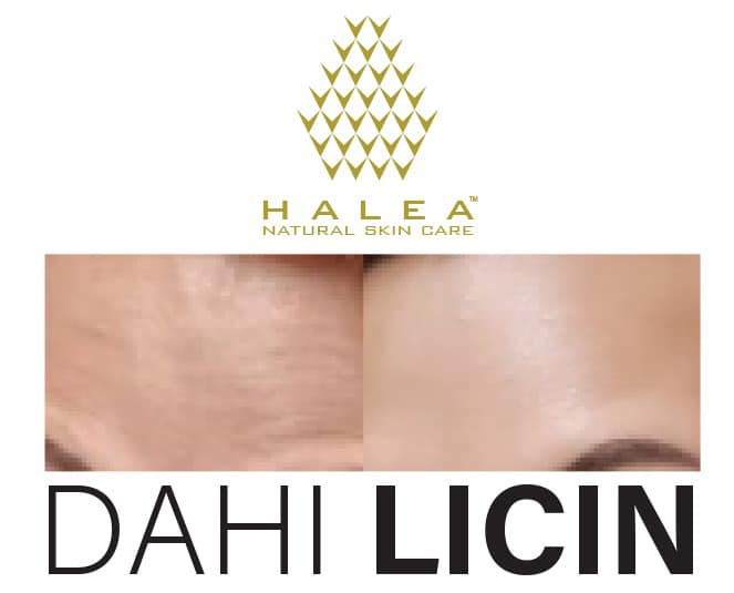 Kulit Cantik Dengan Halea Kulit Cantik Dengan Halea