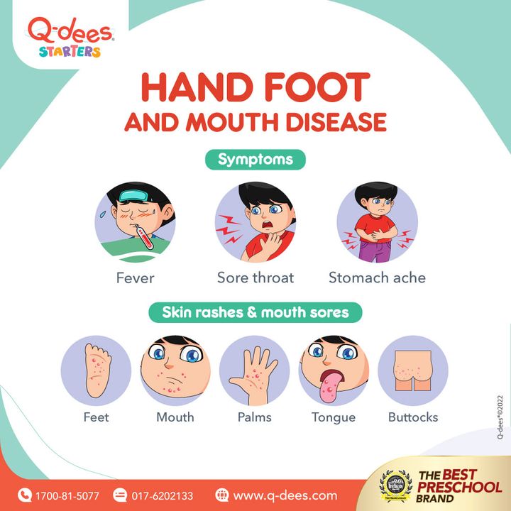 The Hand, Foot And Mouth Disease (hfmd) Has 