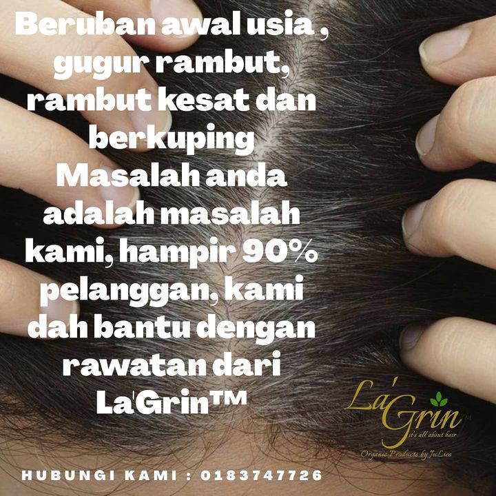Kesan Paraben Ke Atas Kulit Kepala Mula Memang 